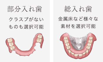 総入れ歯の場合、金属床など様々な素材を選択可能。部分入れ歯は、クラスプがないものも選択可能。