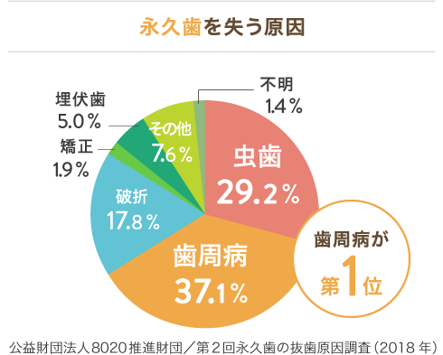 永久歯を失う原因第一位は歯周病