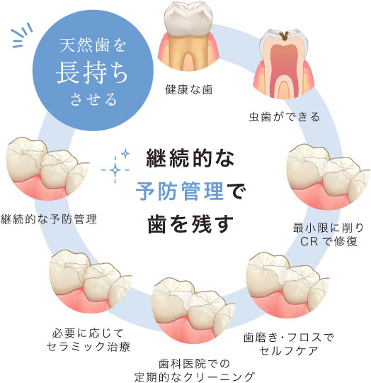 継続的な予防管理で歯を残す